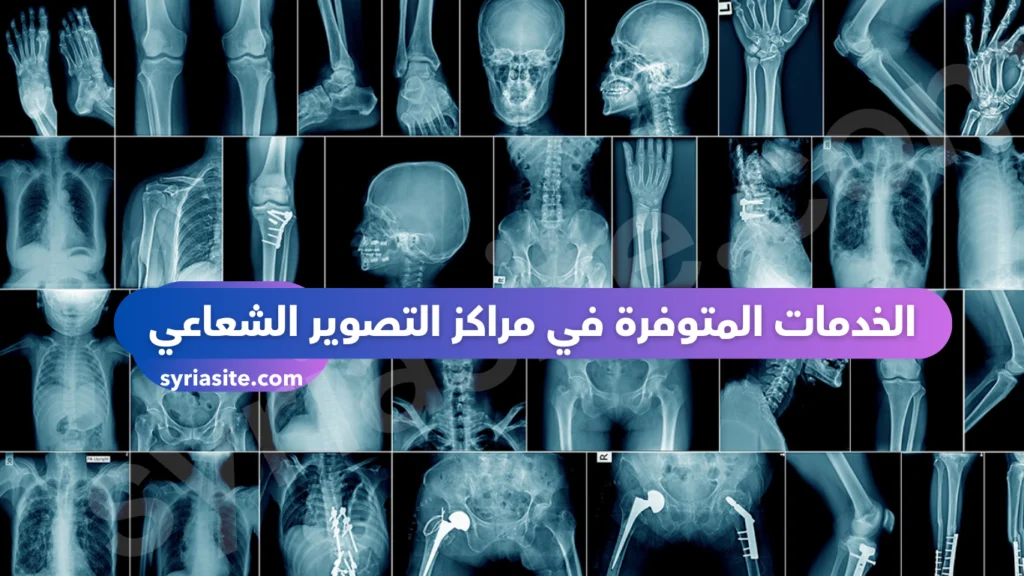 مراكز التصوير الشعاعي 