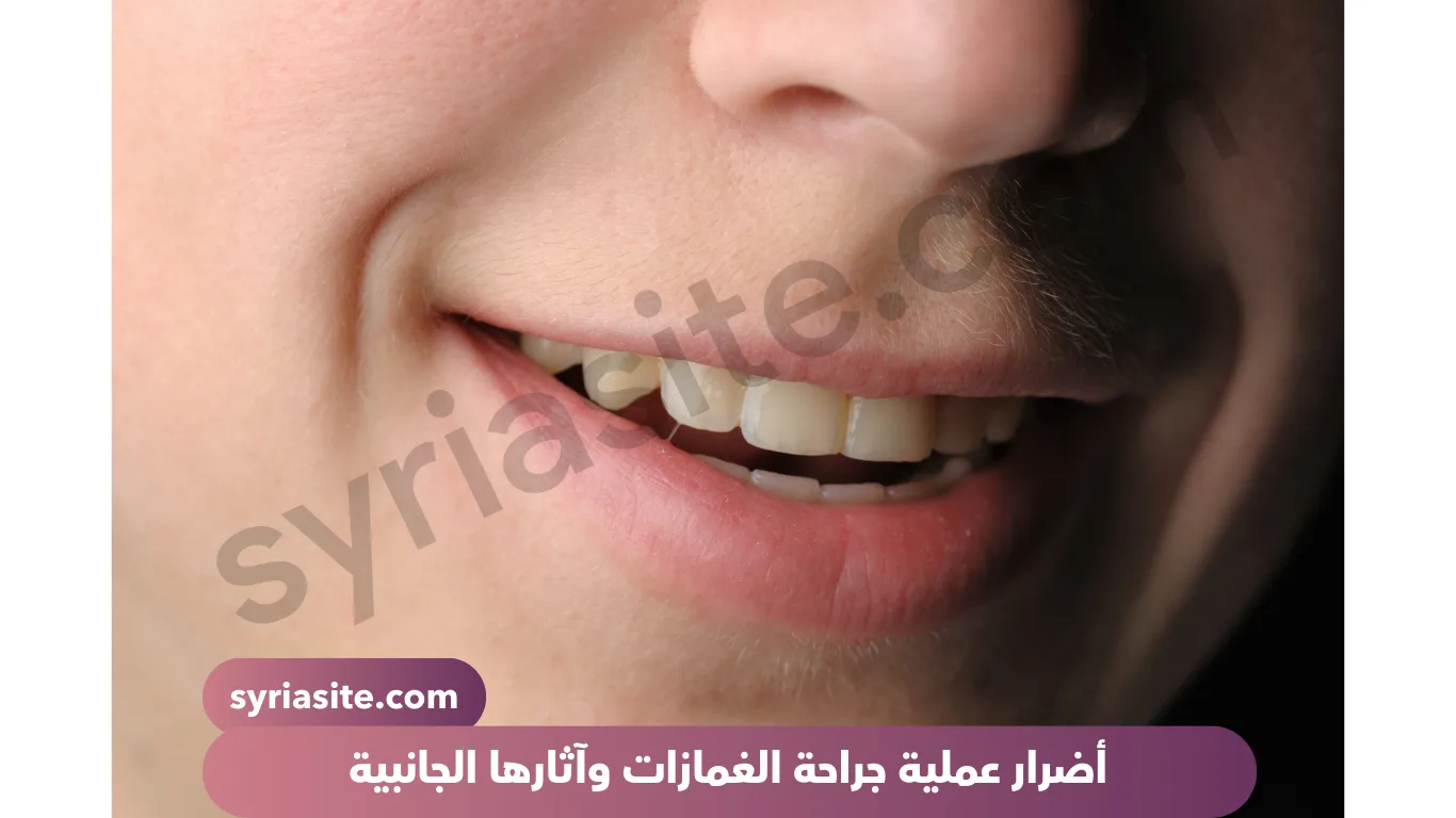 جراحة الغمازات