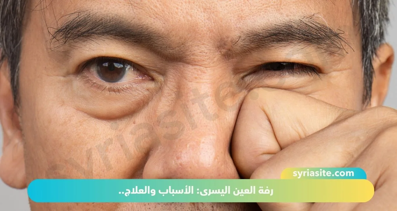 رفة العين اليسرى: الأسباب والعلاج..
