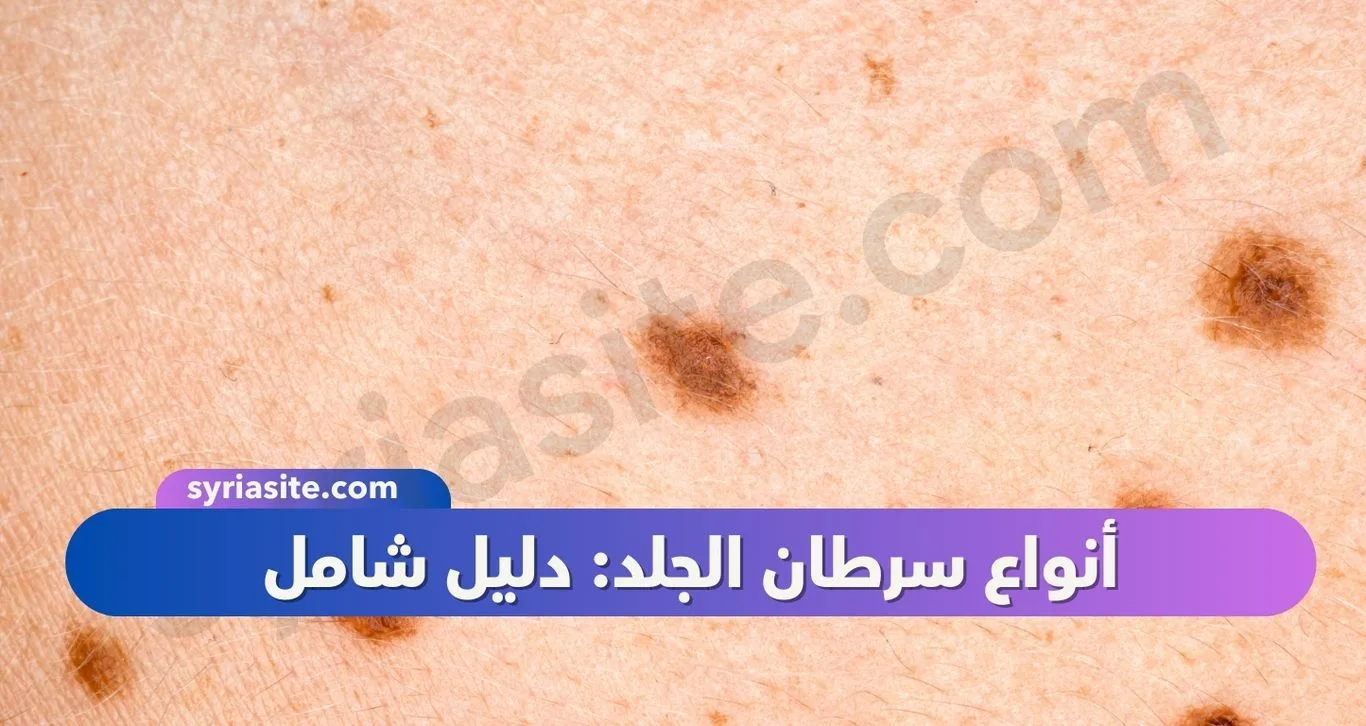 أنواع سرطان الجلد: دليل شامل