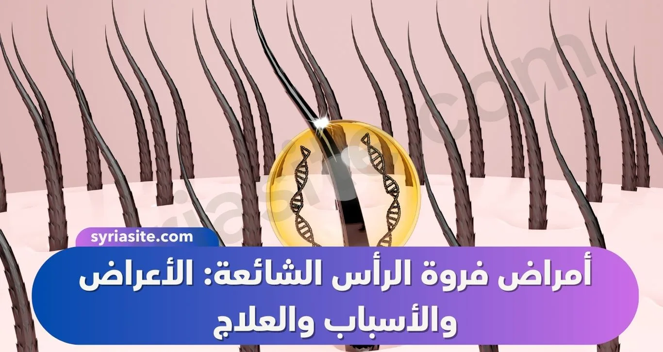 أمراض فروة الرأس الشائعة: الأعراض والأسباب والعلاج