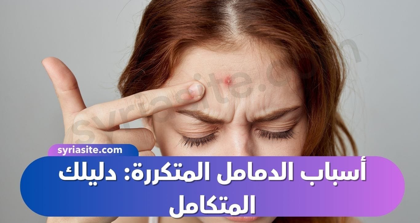 أسباب الدمامل المتكررة: دليلك المتكامل