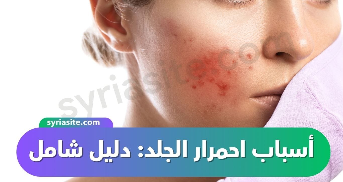 أسباب احمرار الجلد: دليل شامل