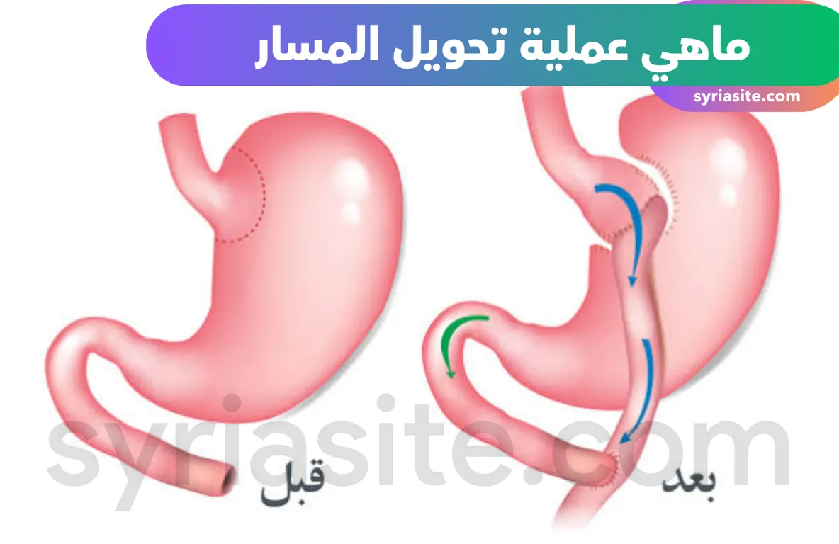 ماهي عملية تحويل المسار