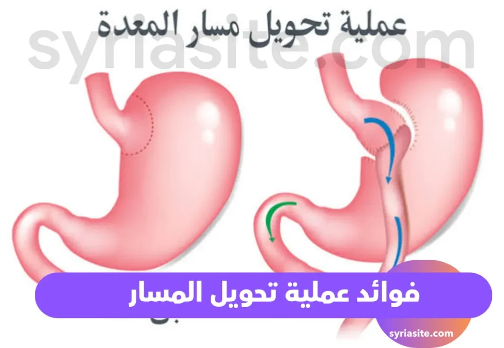 فوائد عملية تحويل المسار