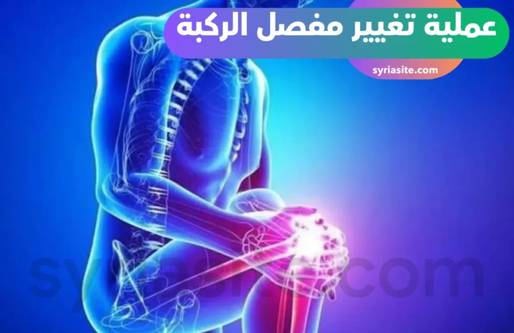 خطوات عملية تغيير مفصل الركبة