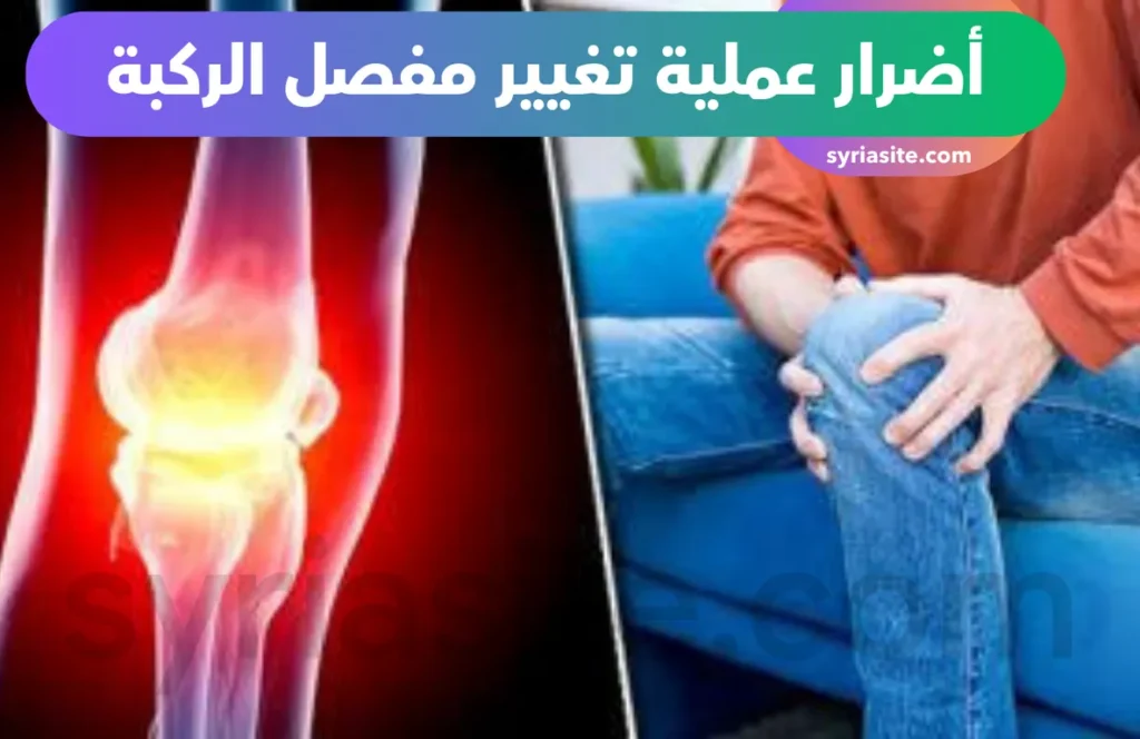 أضرار عملية تغيير مفصل الركبة