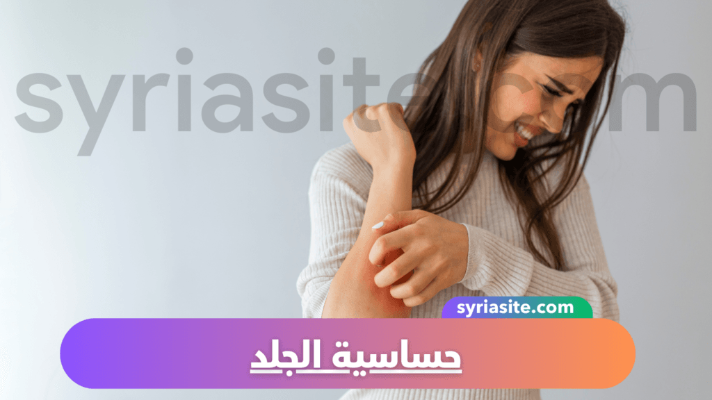 حساسية الجلد