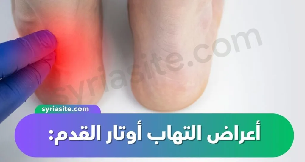 التهاب أوتار القدم: دليل شامل