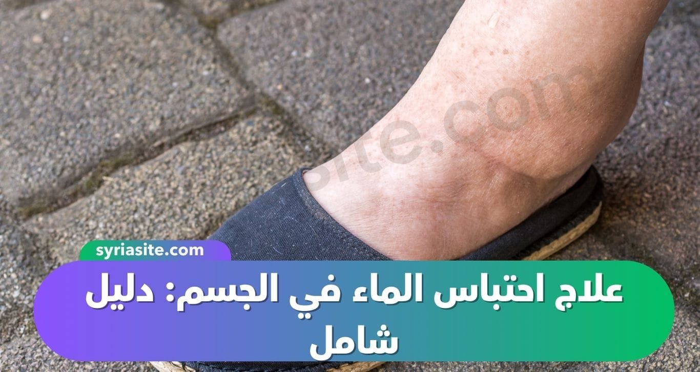 علاج احتباس الماء في الجسم: دليل شامل