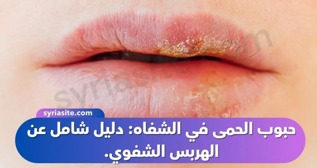 حبوب الحمى في الشفاه: دليل شامل عن الهربس الشفوي.