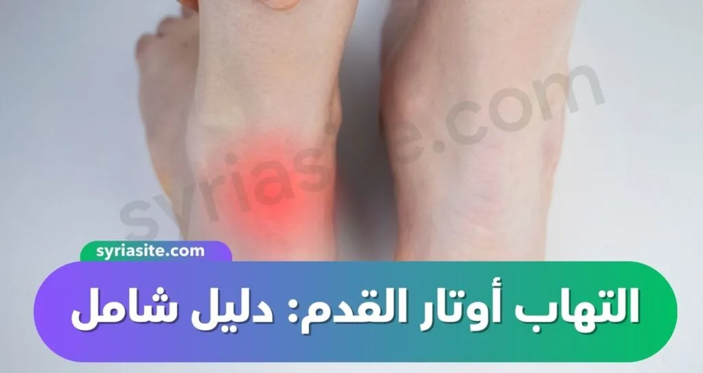 التهاب أوتار القدم: دليل شامل