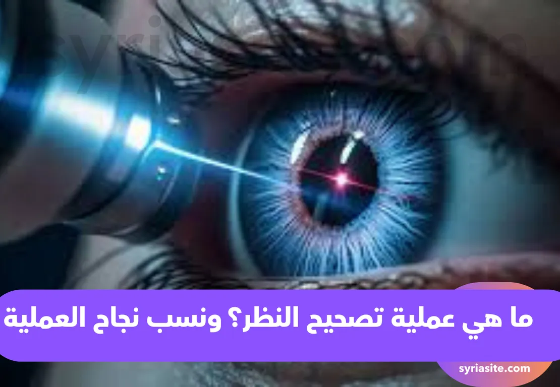 عملية تصحيح النظر