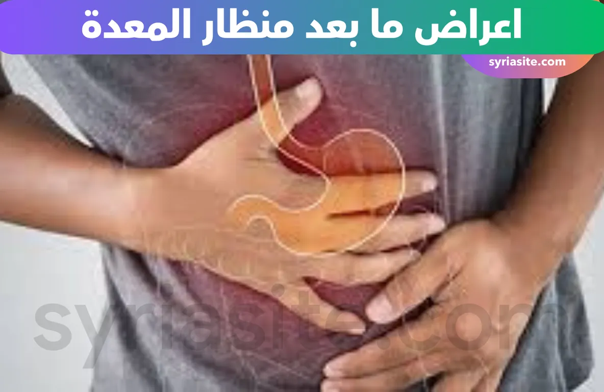 اعراض ما بعد منظار المعدة