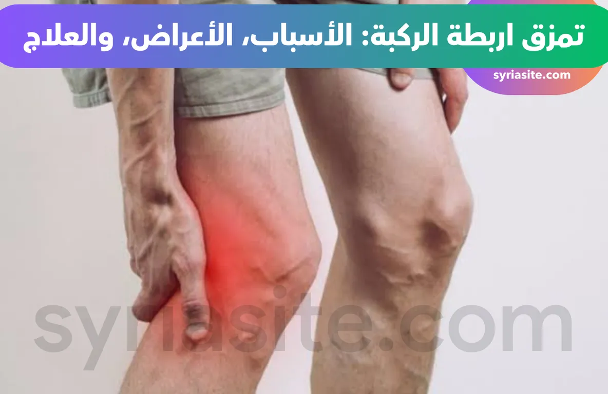 تمزق اربطة الركبة