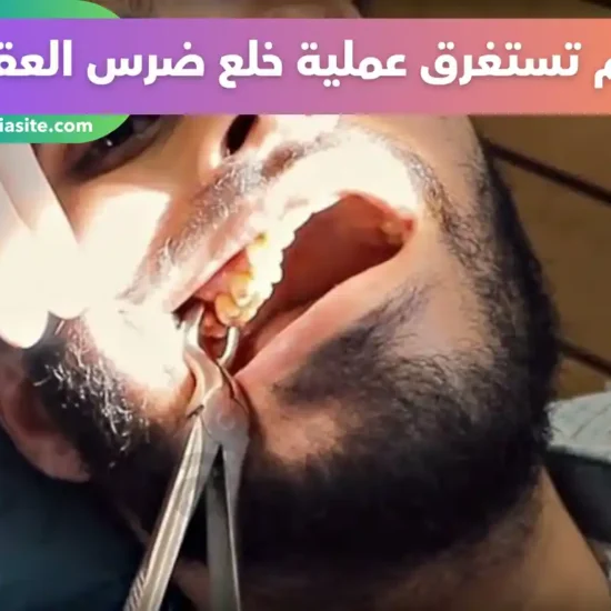 جراحة ضرس العقل