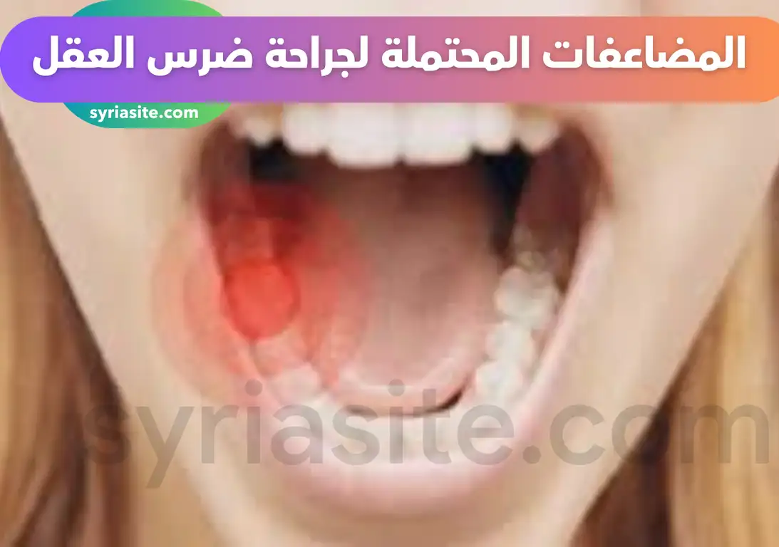 مشفى الأسد الجامعي للعمليات والجراحة المتقدمة