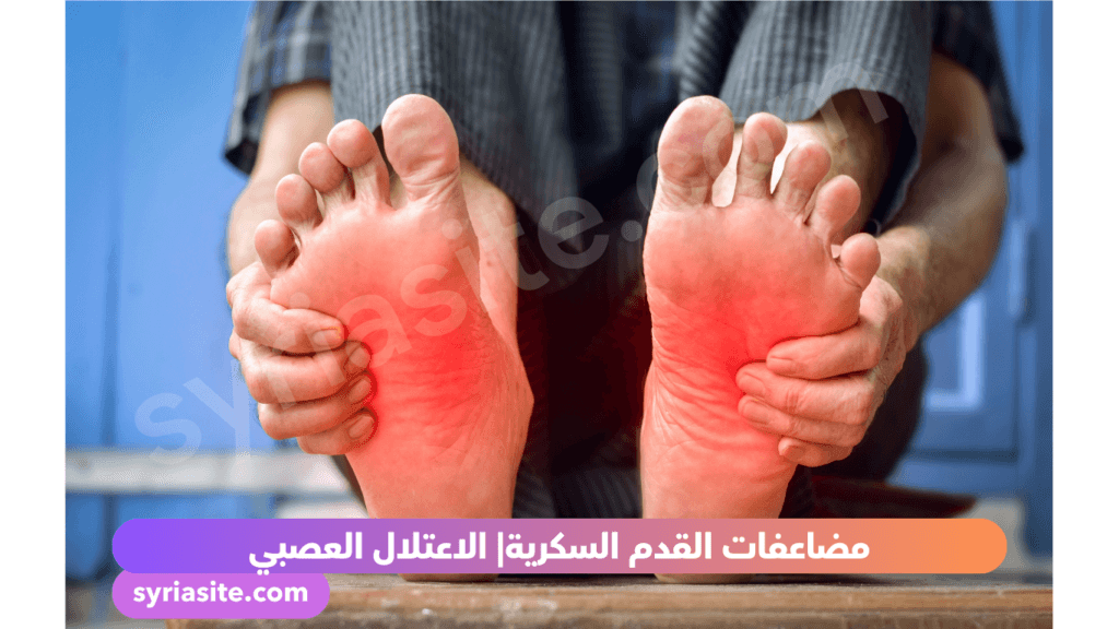الاعتلال العصبي