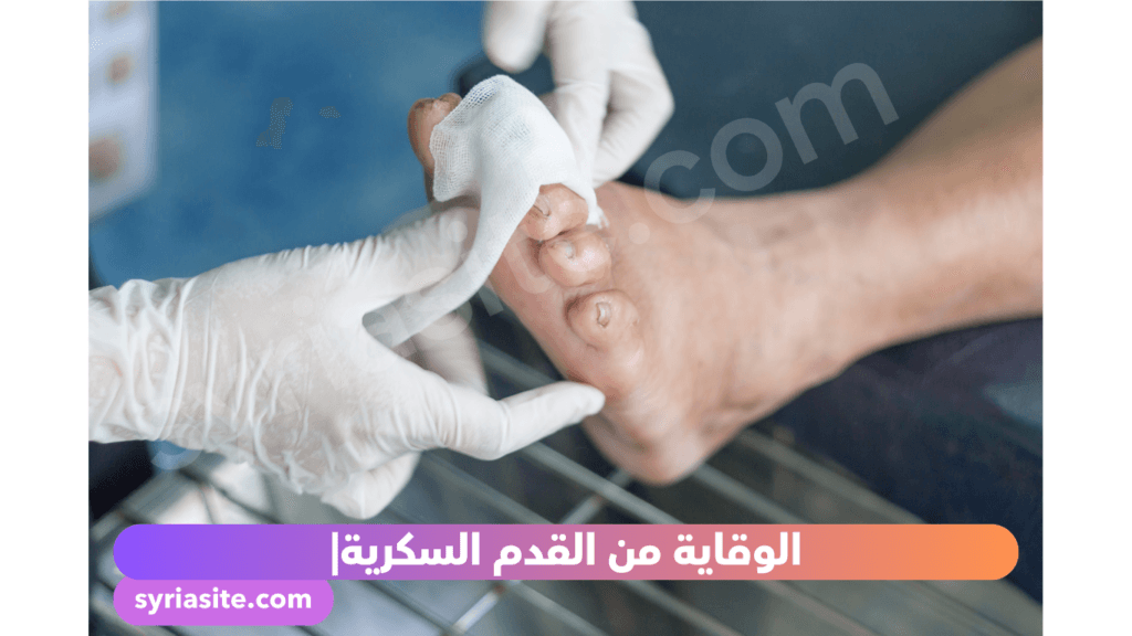 الوقاية من القدم السكرية