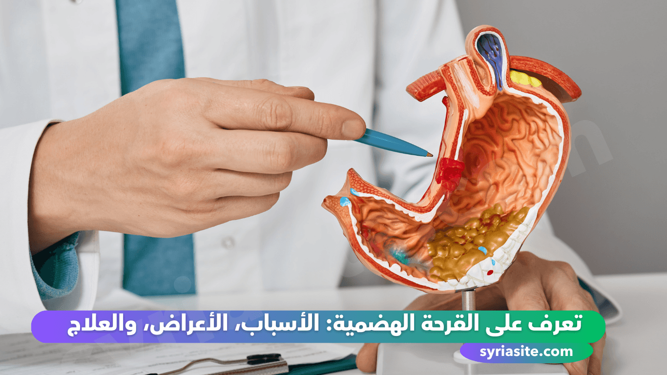 تعرف على القرحة الهضمية: الأسباب، الأعراض، والعلاج