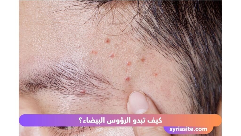 الرؤوس البيضاء
