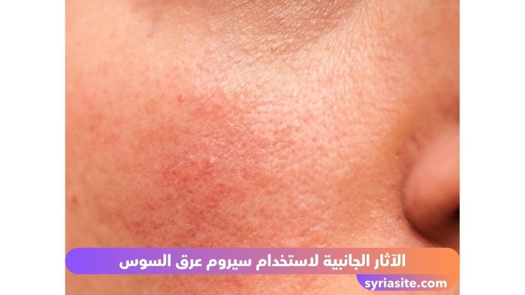سيروم عرق السوس