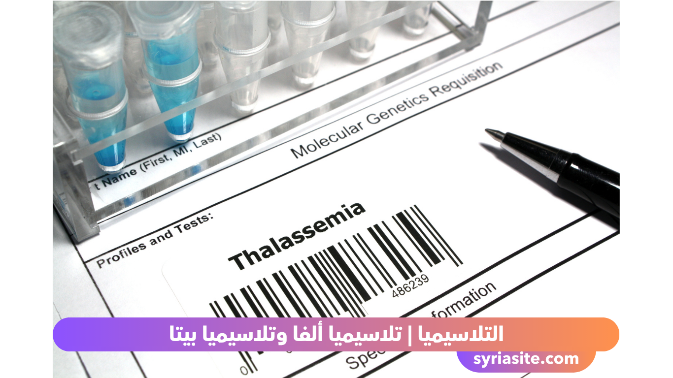 التلاسيميا