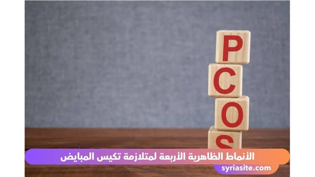 متلازمة تكيس المبايض