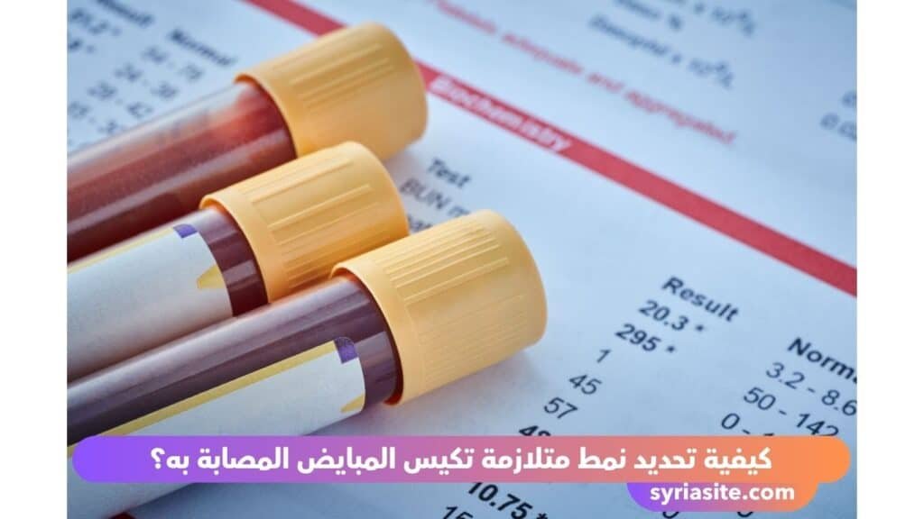 متلازمة تكيس المبايض