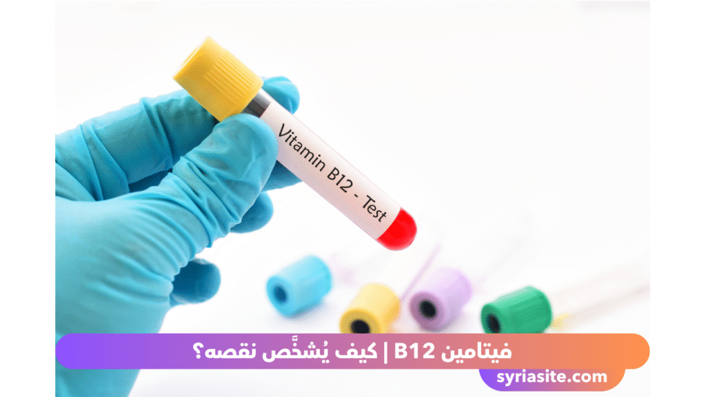 فيتامين B12