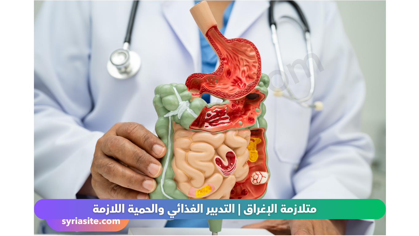متلازمة الإغراق