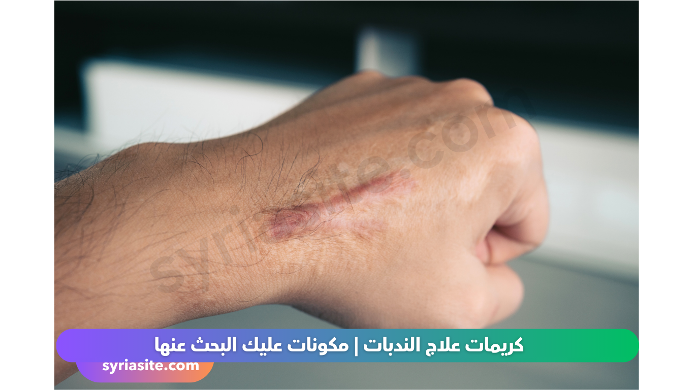 كريمات علاج الندبات
