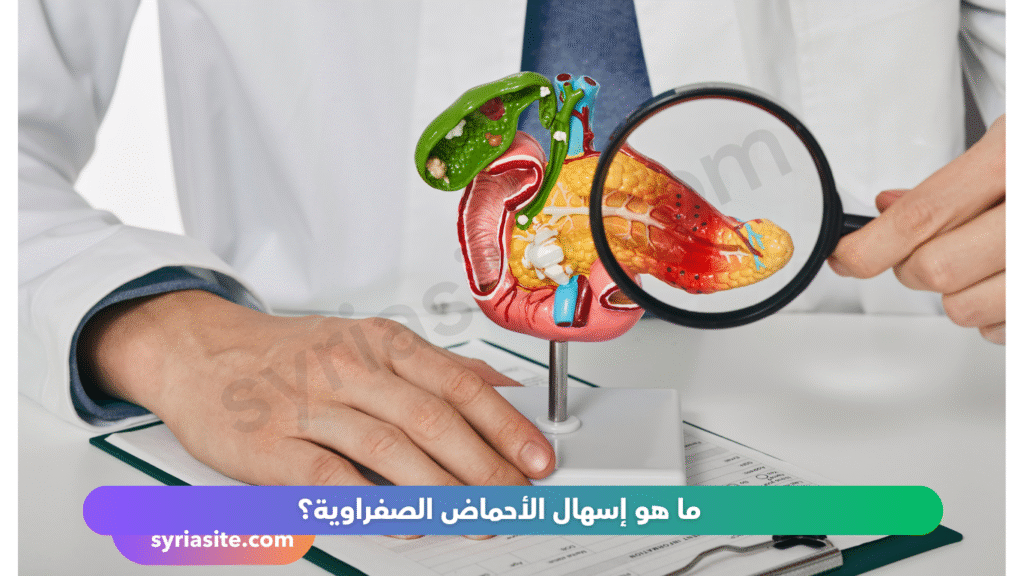 إسهال الأحماض الصفراوية