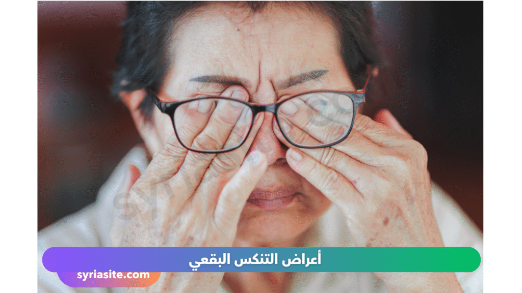التنكس البقعي
