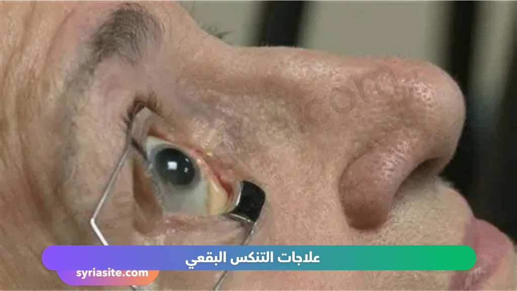 الضمور البقعي المرتبط بالعمر