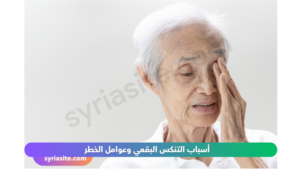 التنكس البقعي
