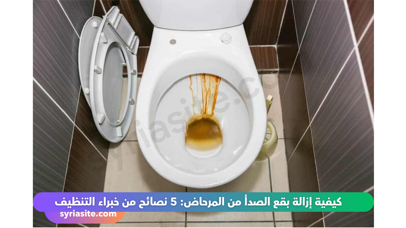 إزالة بقع الصدأ من المرحاض