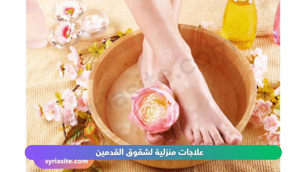 تشقق القدمين