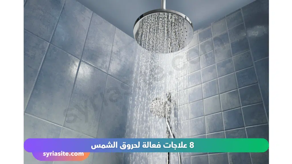 حروق الشمس