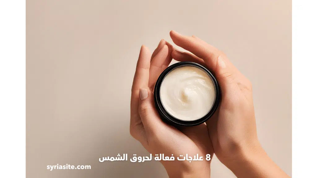 حروق الشمس